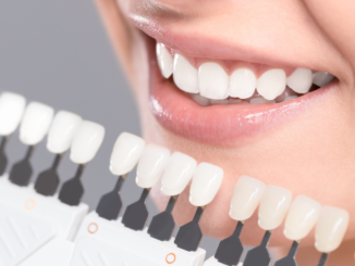 Wybielanie zębów a aparat ortodontyczny – czy warto wiedzieć?
