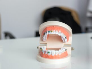Kamuflaż ortodontyczny – poznaj bezoperacyjną metodę leczenia wad zgryzu