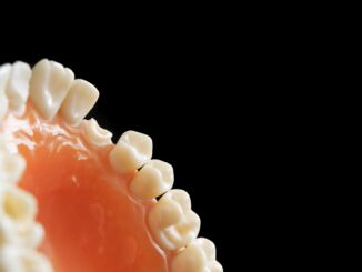 Bonding zębów: Czym jest i dla kogo jest przeznaczony?
